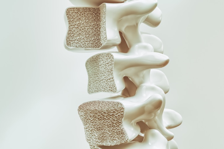 Osteoporosis on the spine -- 3d rendering