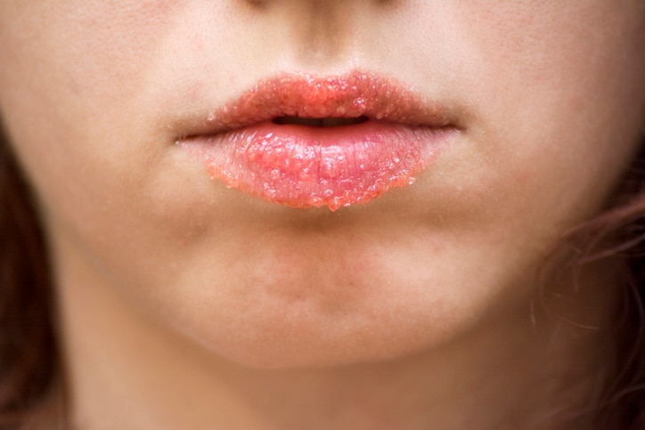 Redhead model using a strawberry homemade lip scrub to exfoliate the skin on her lips