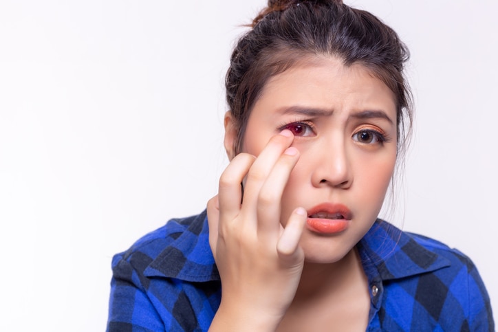 Beautiful young woman get allergic to contact lenses. Young lady gets hurt, painful or irritated eyes. Girl gets conjunctivitis from dirty contact lenses. It is first time to use it. isolated on white