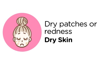 Skin type- dry skin